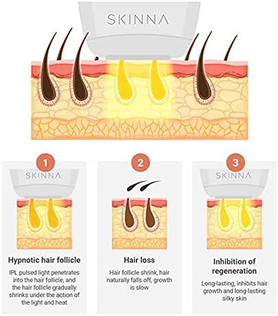 IPL Laser Hair Removal